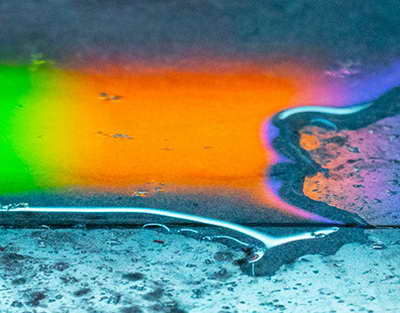 Vərəm xəstəliyinə niyə kişilər daha çox YOLUXUR?